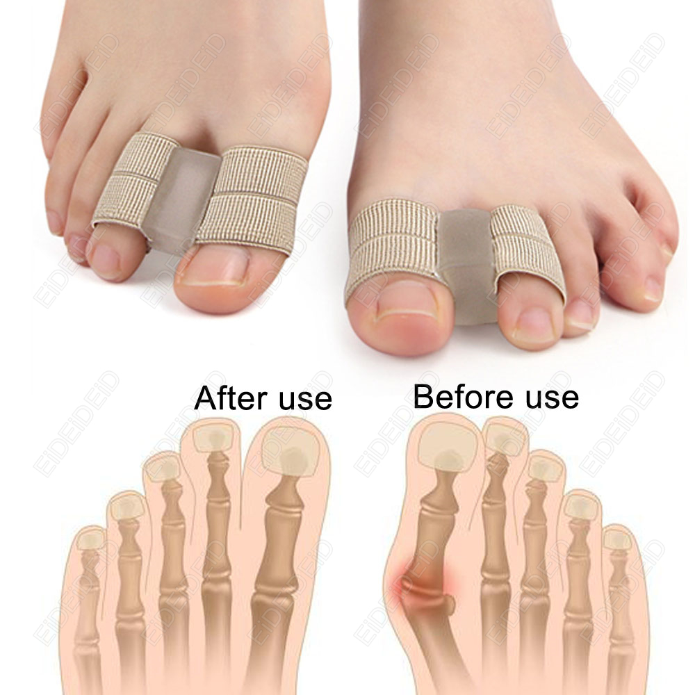 Correttore borsite plantari pi - Women'S Shoes For Bunions recensione e prezzo
